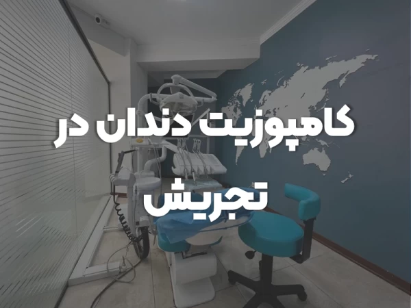 کامپوزیت دندان در تجریش