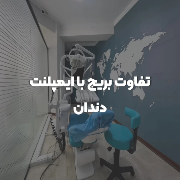 تفاوت بریج با ایمپلنت دندان