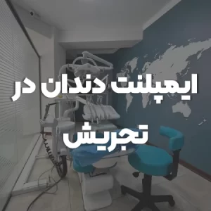 ایمپلنت در تجریش